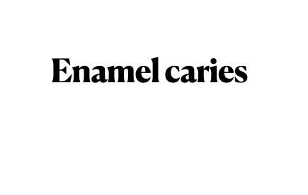 Enamel caries